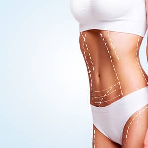 Linea Reafirmante